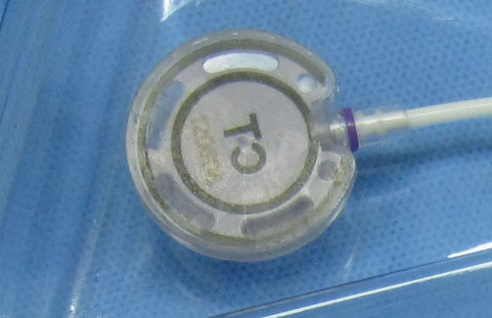 Radio opaque CT marking